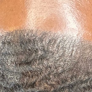 Scalp micropigmentation density, Houston TX