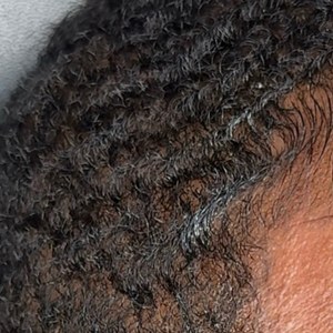 Scalp pigmentation blended into existing hair
