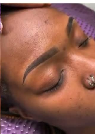 Brows healed, close up